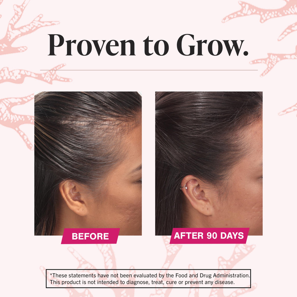 Viviscal Women's Hair Growth Supplement with Collagen | 180 Tablets – Supplementhub
